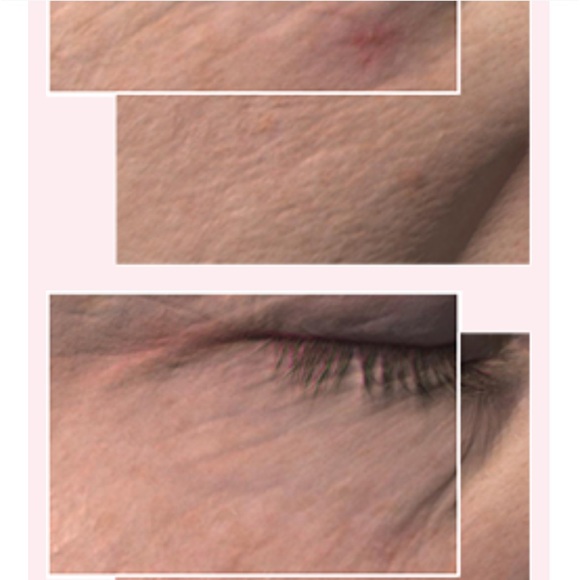 Skincare TimeWise 3D for skin types normal/dry and combination/oily - Picture 6 of 7